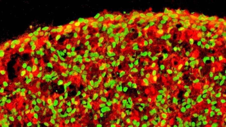 rsz_beta-cell-image-released-salk