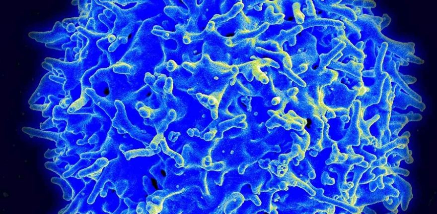 1200px-Healthy_Human_T_Cell-public-domain-wikimedia-commons-National-Institutes-of-Health