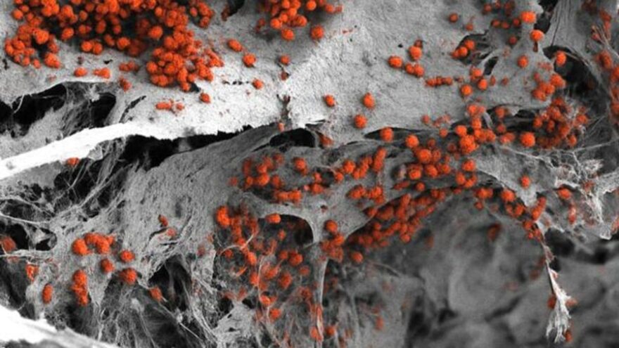 3D bone marrow tissue